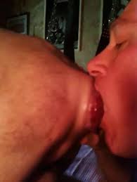 Anal prolapse rimjob jpg x Anal prolapse rimjob
