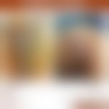 pussy before and after|Labiaplasty a before and b after | Download Scientific Diagram