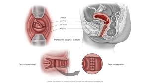 child examination vagina|🌸 Vaginal Examination 🌸 In midwifery care, a Vaginal Examination (VE) can  used to assess the degree of opening of the cervix so that the labour  progress and time of birth can