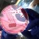 Superbug resistant to last resort antibiotic bound to reach Australia, expert says 