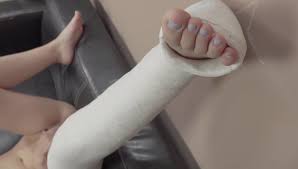 Milf lola broken leg cast joi foot fetish jpg x Leg cast