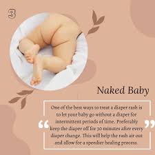 diaper rash naked |6 days old is this a diaper rash? : r/newborns