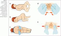 hymen child|Hymen - Wikipedia