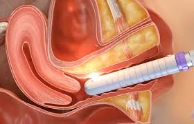 vagina transformation caption|tg caption transformation - SeaArt Al - Free Al Art Generator