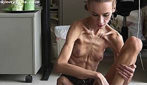 Extreme anorexic porn videos jpg x Anorexic sex