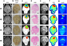 kim yuna nude fake |Cytomorphology and Gene Expression Signatures of Anchorage-independent  Aggregations of Oral Cancer Cells | Cancer Genomics & Proteomics