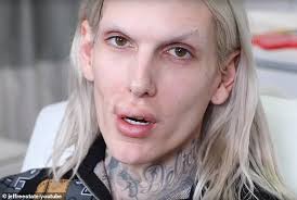 Jeffree star accused of sexual assault jpg x Jeffree star