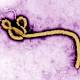 Ebola infected doctors show improvement after taking ZMapp