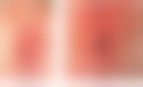  child labia hymen|Hymen and virginity: What every paediatrician should know - Moussaoui -  2022 - Journal of Paediatrics and Child Health - Wiley Online Library