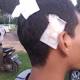 Kepalanya Bocor, Seorang Pemuda Laporkan Oknum Anggota TNI ... - Tribunnews