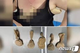 여자초등학생 가슴|남자도 여자처람 가슴이 커지나요? 강남 여유증 : 닥터화니의 가슴성형 이야기