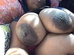 Black areolas jpg x Black areolas