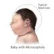 Brazil researchers: Microcephaly screening alone won't detect all cases of Zika virus in newborns 