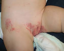child examination vagina|🌸 Vaginal Examination 🌸 In midwifery care, a Vaginal Examination (VE) can  used to assess the degree of opening of the cervix so that the labour  progress and time of birth can
