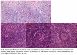 Pre pubertal girls nude |Alterations in pain during adolescence and puberty: Trends in Neurosciences