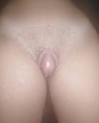 Big clit erect giant clit jpg x Giant clit