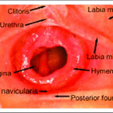 prepubertAL VAGINA|Vaginal bleeding in the prepubertal child | CMAJ