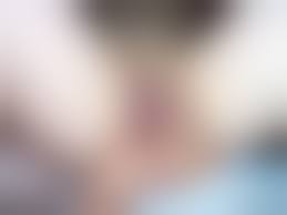 陰核まんこ無修正|症例写真】小陰唇縮小+クリトリス包茎手術を行った40代女性の症例：美容外科 高須クリニック