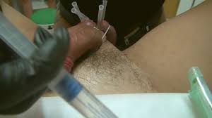 Urethral stimulation jpg x Urethral stimulation