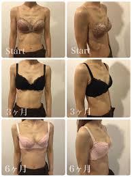 貧乳 おっぱい|貧乳でお悩みの方のブラ選びについて・人気ランキング | バストアップサロンRococo（ロココ）