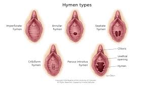 hymen child|