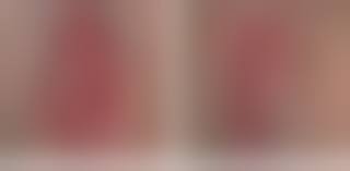 Hymen vagina|Hymen - Wikipedia