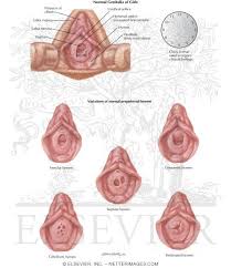  child labia hymen|Child Sexual Abuse Clinical Presentation: History, Physical