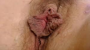 Easaatbwx mch jpg x Vulva tube