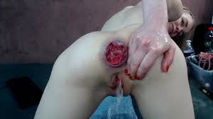 Anal prolapse gape porn videos xhamster gif x Prolapse anal gape