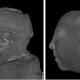 Brain Scans of Brazilian Babies Show Array of Zika Effects 