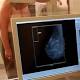 Botched breast screening: Adelaide woman lodges $94k legal claim against SA ... 