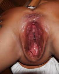 Eaftggaaaa rbzawxotz jpg x Vagina gaping pussy