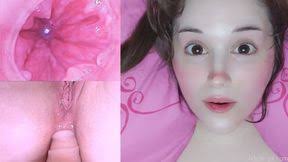 Qiy zbeqglhgaaawavb cbgz jpg x Endoscope anal