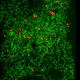 Health|Could Alzheimer's Stem From Infections? It Makes Sense, Experts Say 