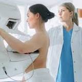 Mammography screening tied to better breast cancer characteristics, outcomes