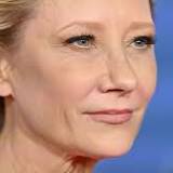 'How could you survive that?': Anne Heche stable after fiery car crash
