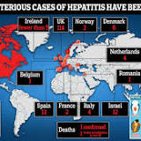 First possible US death reported in international outbreak of child hepatitis