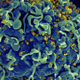 Californische onderzoekers kondigen herstel van vierde hiv-patiënt aan