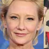 Anne Heche hospitalized after fiery car crash