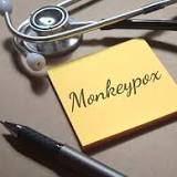 Do you need a mask to protect you from monkeypox?
