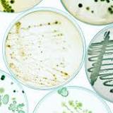 Bacterial Infections Responsible For Huge Number of Deaths Worldwide