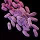 http://www.foxnews.com/health/2016/05/19/unaddressed-superbugs-could-kill-every-3-seconds-by-2050-report-suggests.html
