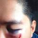 Cairns man seeks CCC investigation into alleged assault by officer during ... 