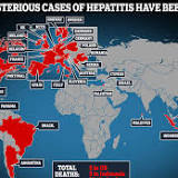 700  unusual hepatitis cases reported in 34 countries: 4 updates