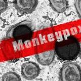 Brazil has already recorded at least 16 cases of monkeypox