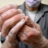 Ease fears about monkeypox & pets
